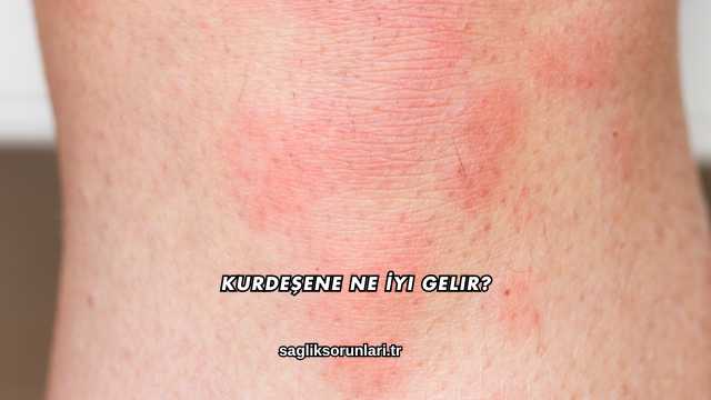 Kurdeşene Ne İyi Gelir?