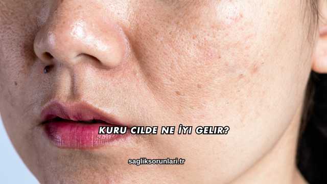 Kuru Cilde Ne İyi Gelir?