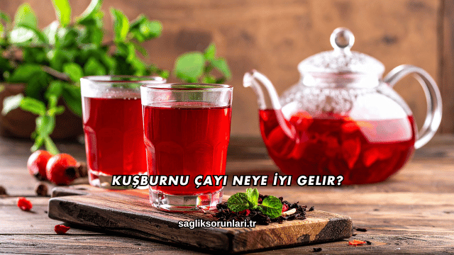 Kuşburnu Çayı Neye İyi Gelir?