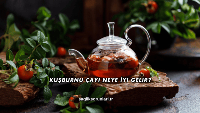 Kuşburnu Çayı Neye İyi Gelir?