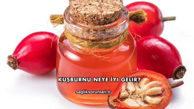 Kuşburnu Neye İyi Gelir?