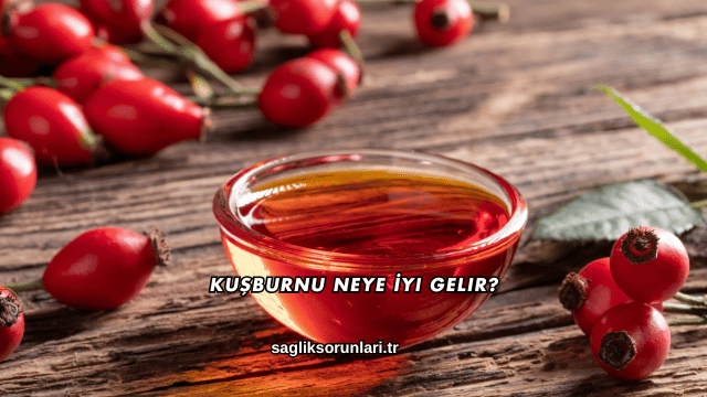 Kuşburnu Neye İyi Gelir?