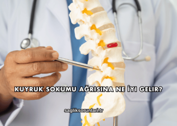 Kuyruk Sokumu Ağrısına Ne İyi Gelir?