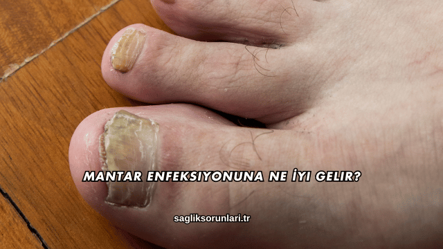 Mantar Enfeksiyonuna Ne İyi Gelir?