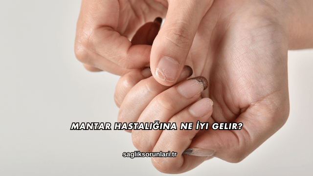 Mantar Hastalığına Ne İyi Gelir?