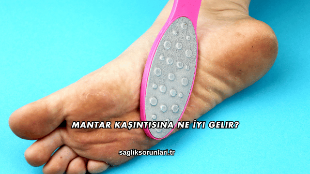 Mantar Kaşıntısına Ne İyi Gelir?