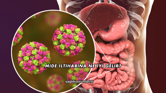 Mide İltihabına Ne İyi Gelir?