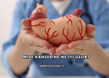 Mide Kanserine Ne İyi Gelir?