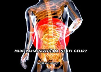 Mide Rahatsızlığına Ne İyi Gelir?