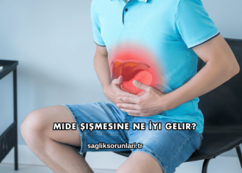 Mide Şişmesine Ne İyi Gelir?