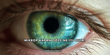 Mikrop Kapan Göze Ne İyi Gelir?
