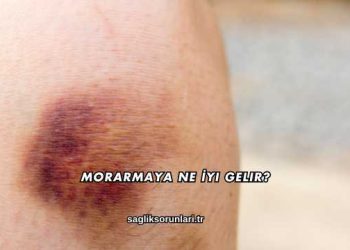 Morarmaya Ne İyi Gelir?