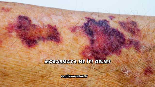 Morarmaya Ne İyi Gelir?