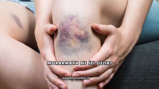 Morarmaya Ne İyi Gelir?