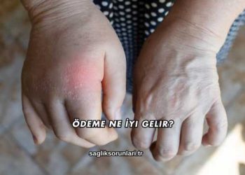 Ödeme Ne İyi Gelir?