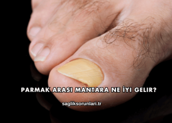 Parmak Arası Mantara Ne İyi Gelir?