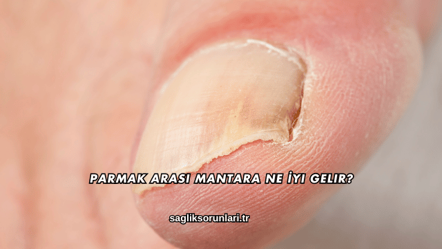 Parmak Arası Mantara Ne İyi Gelir?