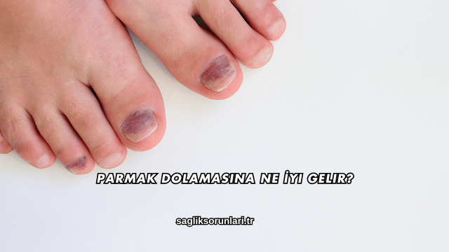Parmak Dolamasına Ne İyi Gelir?