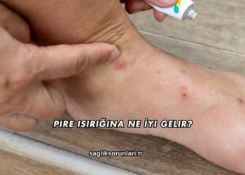 Pire Isırığına Ne İyi Gelir?