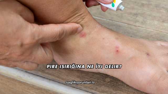 Pire Isırığına Ne İyi Gelir?