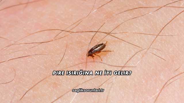 Pire Isırığına Ne İyi Gelir?