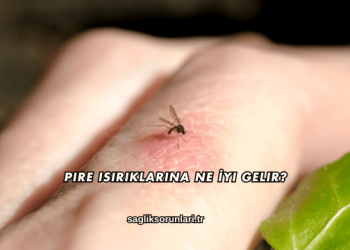 Pire Isırıklarına Ne İyi Gelir?