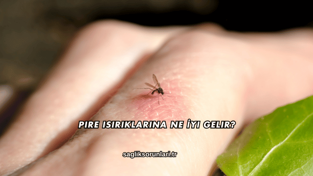 Pire Isırıklarına Ne İyi Gelir?