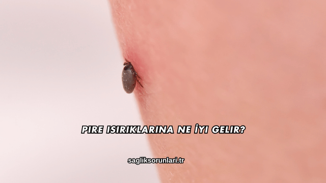 Pire Isırıklarına Ne İyi Gelir?