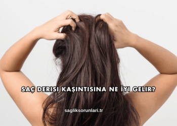 Saç Derisi Kaşıntısına Ne İyi Gelir?