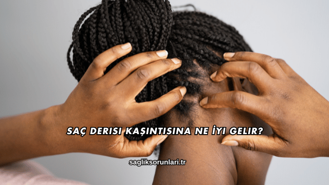Saç Derisi Kaşıntısına Ne İyi Gelir?