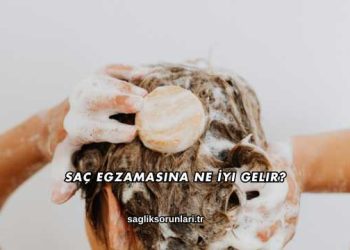 Saç Egzamasına Ne İyi Gelir?