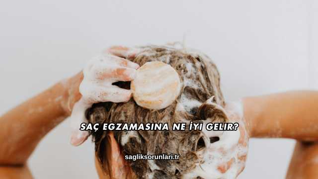 Saç Egzamasına Ne İyi Gelir?