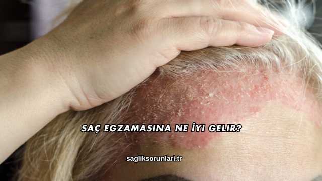 Saç Egzamasına Ne İyi Gelir?