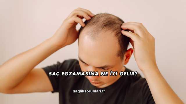 Saç Egzamasına Ne İyi Gelir?