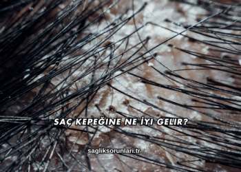 Saç Kepeğine Ne İyi Gelir?