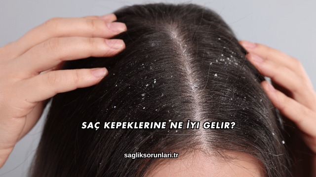 Saç Kepeklerine Ne İyi Gelir?