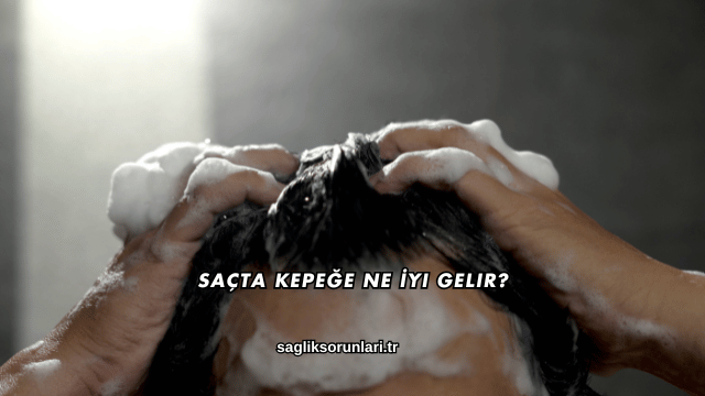 Saçta Kepeğe Ne İyi Gelir?