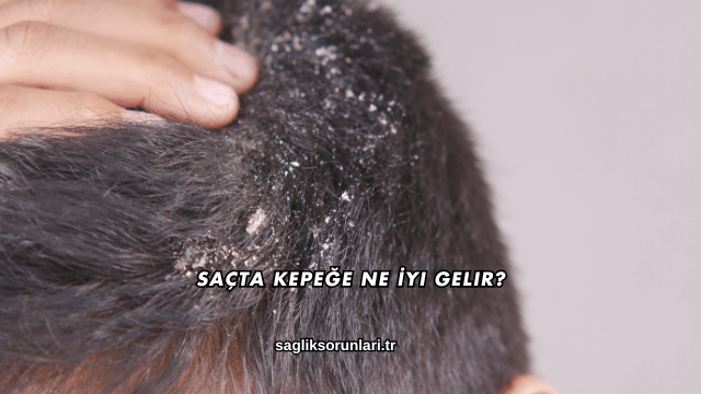 Saçta Kepeğe Ne İyi Gelir?