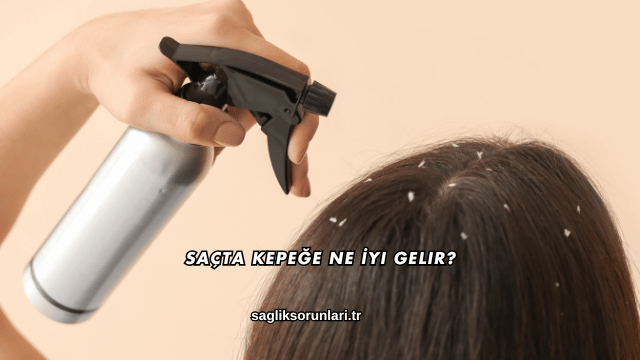 Saçta Kepeğe Ne İyi Gelir?