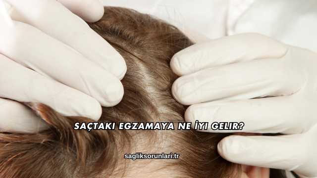 Saçtaki Egzamaya Ne İyi Gelir?