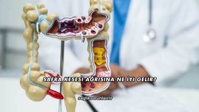 Safra Kesesi Ağrısına Ne İyi Gelir?