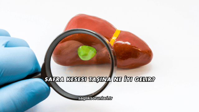Safra Kesesi Taşına Ne İyi Gelir?