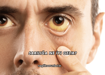 Sarılığa Ne İyi Gelir?