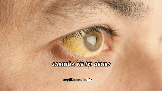 Sarılığa Ne İyi Gelir?