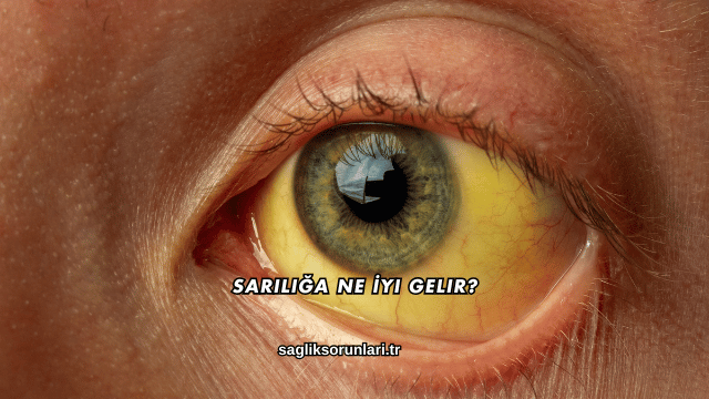 Sarılığa Ne İyi Gelir?