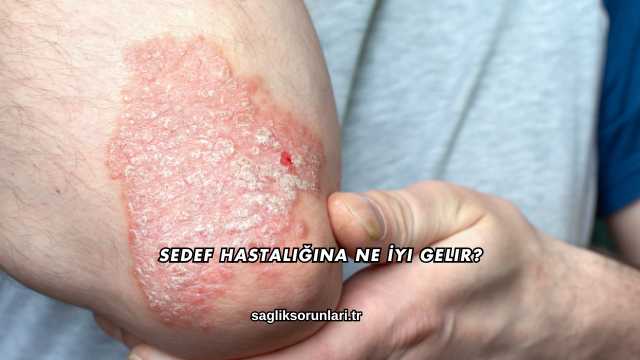 Sedef Hastalığına Ne İyi Gelir?