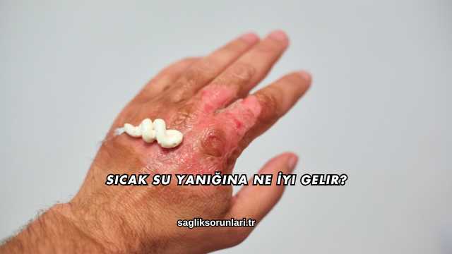 Sıcak Su Yanığına Ne İyi Gelir?