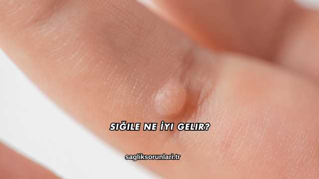 Siğile Ne İyi Gelir?