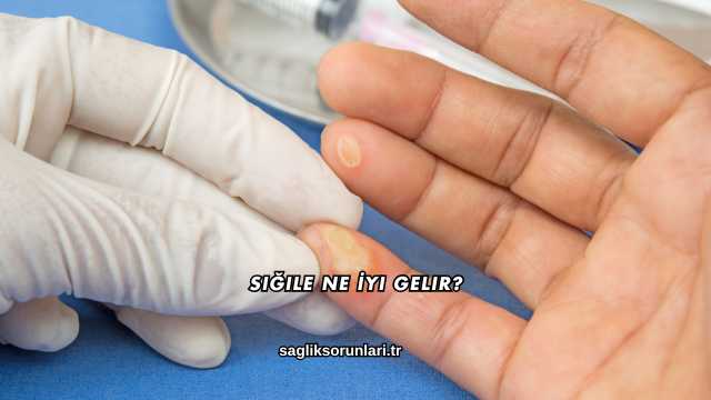 Siğile Ne İyi Gelir?