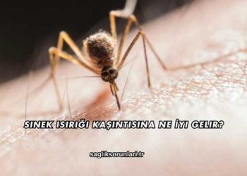 Sinek Isırığı Kaşıntısına Ne İyi Gelir?
